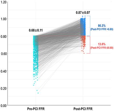 Effect of Coronary Disease Characteristics on Prognostic Relevance of Residual Ischemia After Stent Implantation